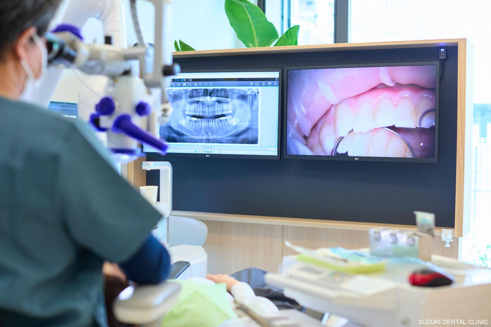 マイクロスコープによる歯科治療